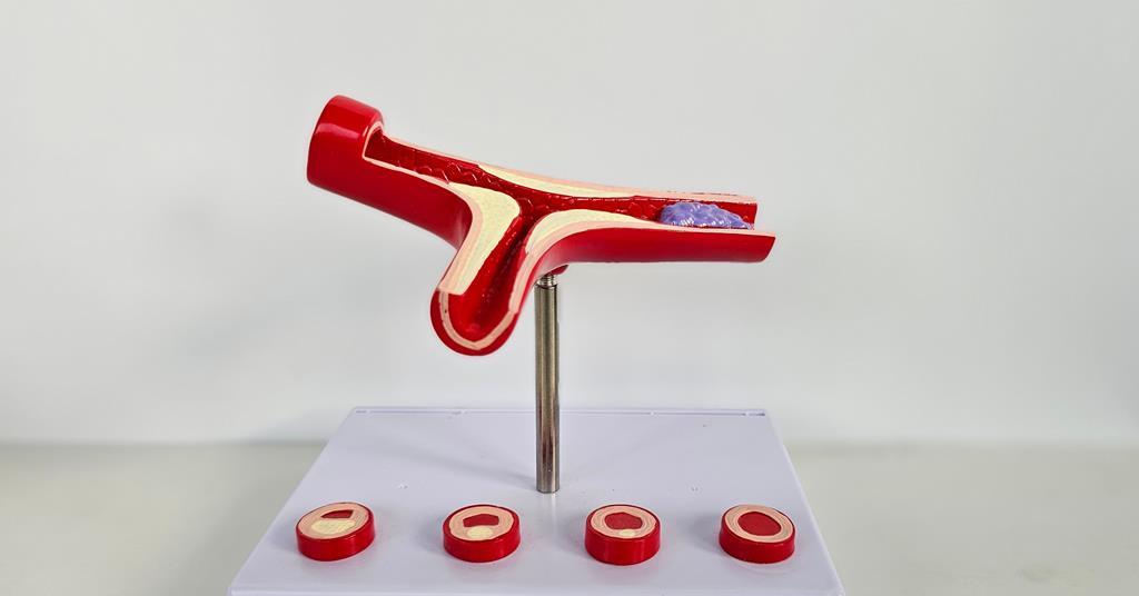 Thromboxane A₂ receptor structure mapped for blood clotting drug development
