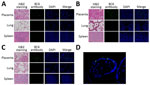 Histologic findings from 3 fatal gestational psittacosis cases caused by C. psittaci strains belonging to closely related multilocus sequence typing lineages, Japan, 2017–2024. A–C) Hematoxylin and eosin staining (scale bar = 50 µm; original magnification ×20) and immunofluorescence microscopy of the placenta, lung, and spleen are shown for case FO-01 (A), case YO-02 (B), and case NO-03 (C). Specific fluorescence observed via immunofluorescence using C. psittaci BC6 rabbit antibody staining. Nuclei were stained with DAPI. Merge column indicates BC6 antibody staining and DAPI. Original magnification ×20. D) High-magnification view (original magnification ×60) of the villi. DAPI, 4′,6-diamidino-2-phenylindole; H&E, hematoxylin and eosin.