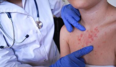 7 Facts You Need to Know