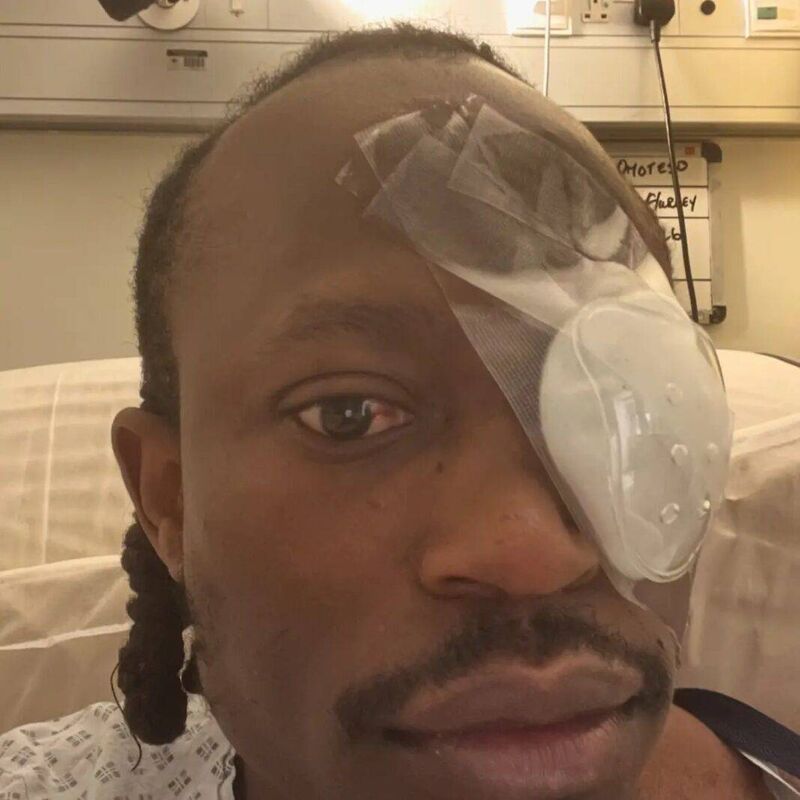 Tobi Omoteso was assaulted in Limerick city on Saturday, March 28.
