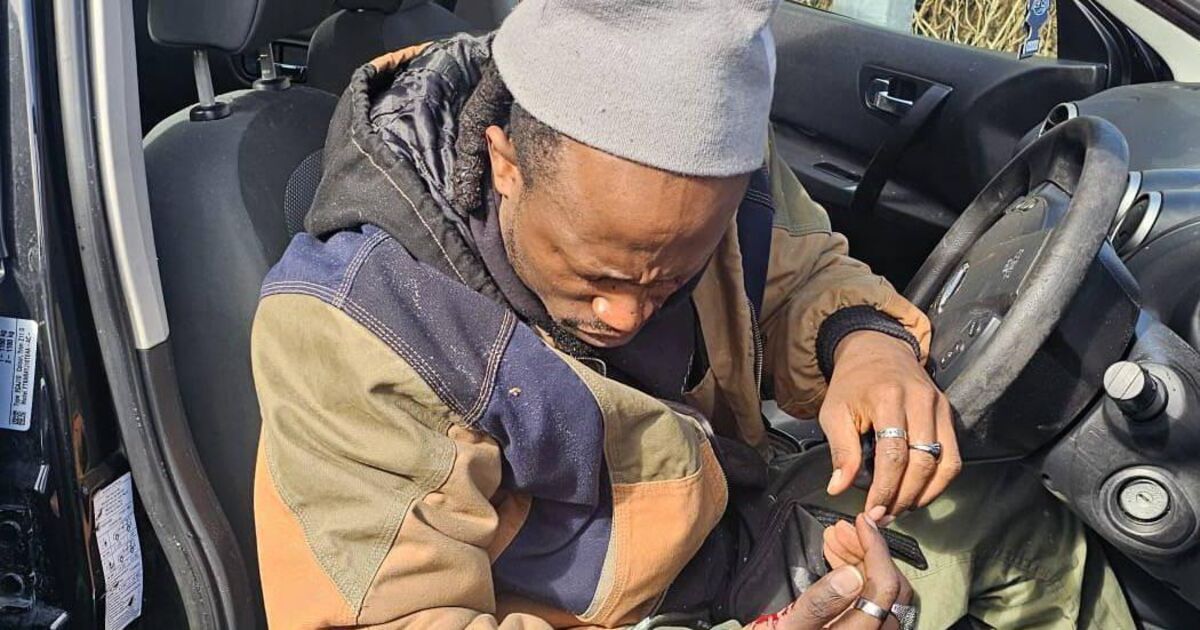 Artist faces 'agonising' eye surgeries after assault in Limerick city