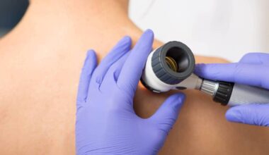 Cork families must travel to Dublin for specialist dermatology care