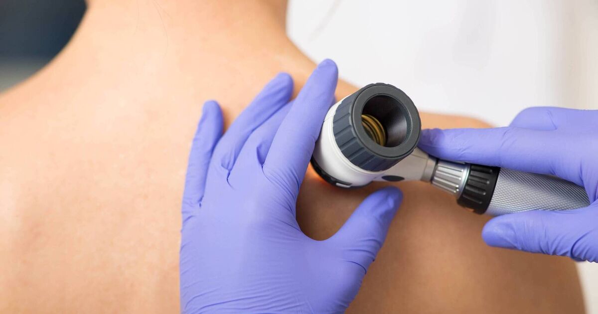 Cork families must travel to Dublin for specialist dermatology care