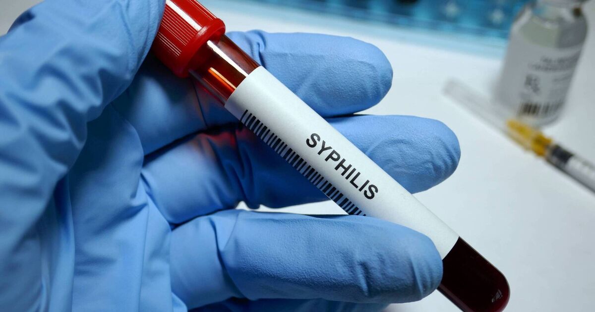 5,160 sexual transmitted infections recorded in first three months of 2026