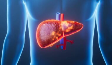 Liver disease to affect 1.8 billion people worldwide by 2050, study suggests