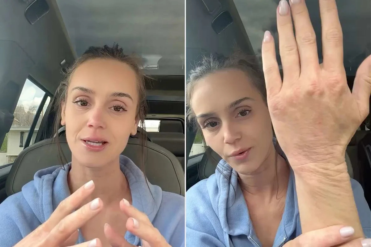 Mikayla Matthews Breaks Down in Tears as She Reveals How Chronic Illness Has Stripped Her of 'So Much Happiness'