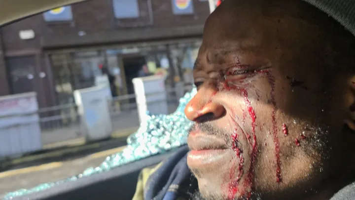 Victim of serious Limerick road-rage attack says he will "keep celebrating life"