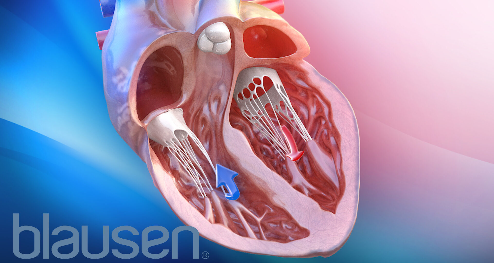 Scientists Find People with Severe Obesity and Heart Failure Have Weakened Heart Muscle Contractions. Weight Loss May Reverse This Condition