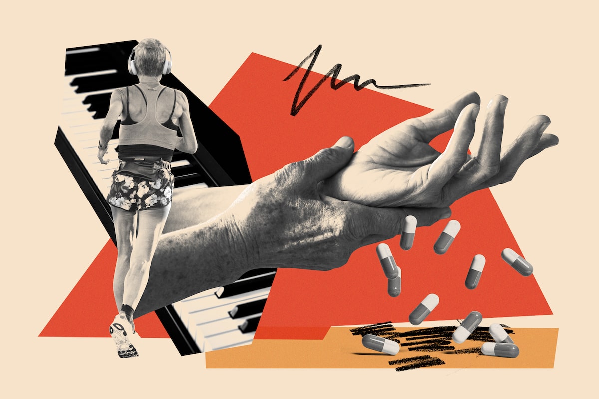 How to effectively manage osteoarthritis