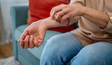 Technology could cut dermatology waiting lists but ‘urgent need’ for more consultants, Hiqa says – The Irish Times