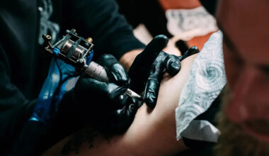 After getting a series of tattoos, she developed pain and blurry vision in her right eye