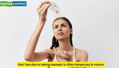 Endocrinologist Links Ozempic Weight Loss to Temporary Hair Shedding