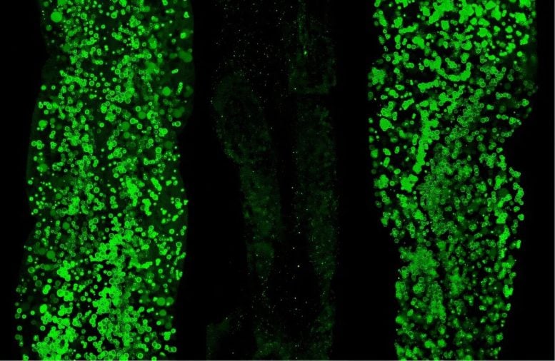 Fat Storage Changes in Caenorhabditis elegans Worms
