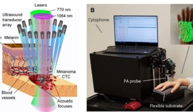 Earliest deadly disease diagnosis and treatment with cytophone