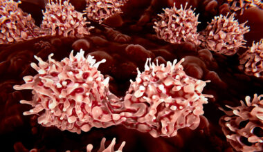 Stem Cell Editing Programs the Immune System to Make Own Therapeutic Proteins