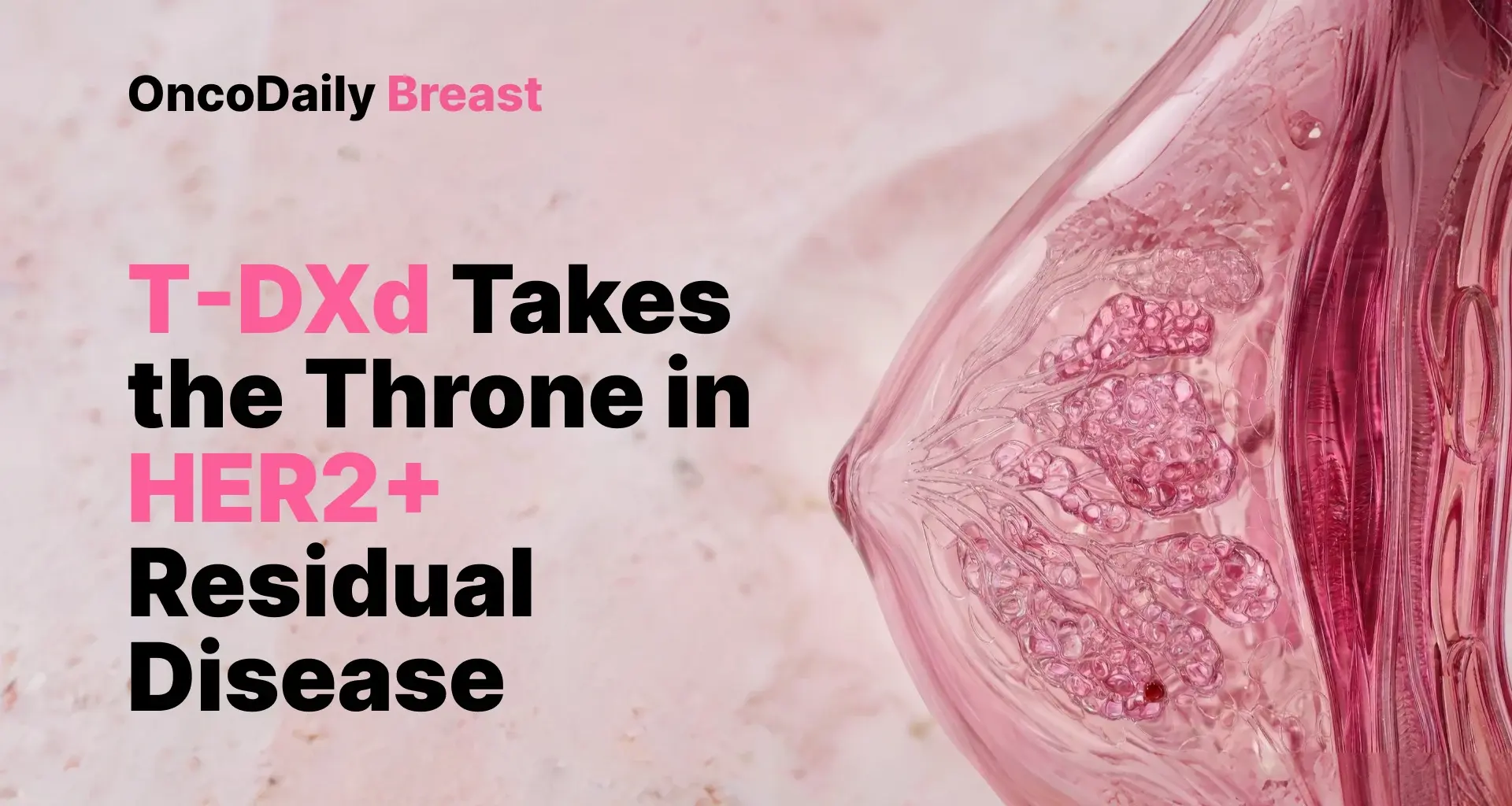 The Throne Has Changed Hands: T-DXd Displaces T-DM1 in Post-Neoadjuvant HER2+ Breast Cancer