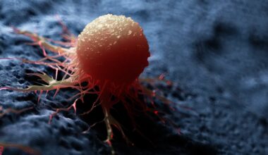 New blood test spots four cancers and other diseases by stripping away healthy DNA noise