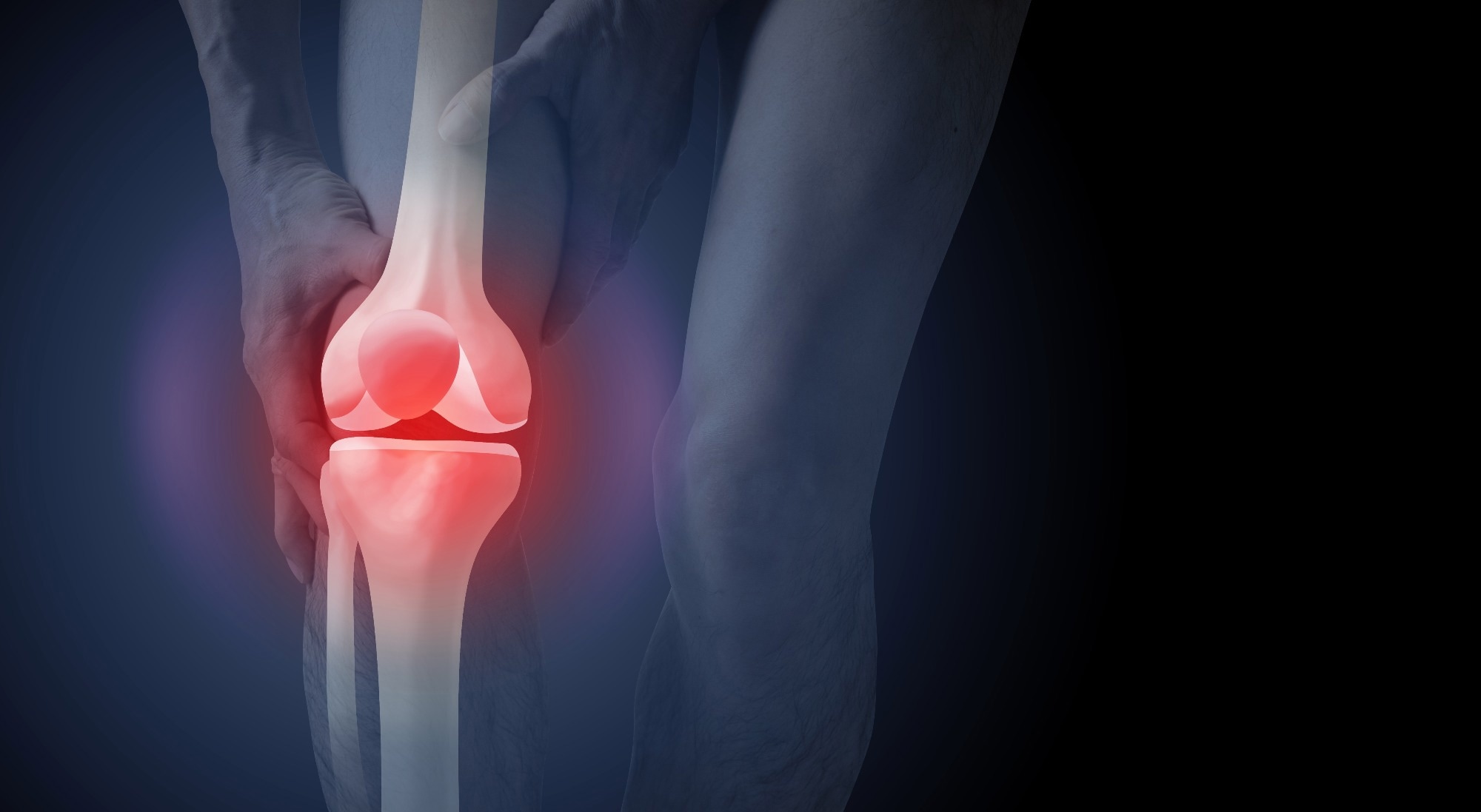 Study: Ultra-processed Foods and Muscle Fat Infiltration at Thigh MRI: Data from the Osteoarthritis Initiative. Image Credit: Atiketta Sangasaeng / Shutterstock