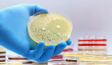 A microbiological culture Petri dish with bacteria where an antibiotic resistance test has been carried