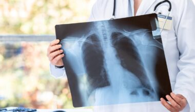 Unions hoping meeting on Long Covid will produce resolution for frontline health workers – The Irish Times