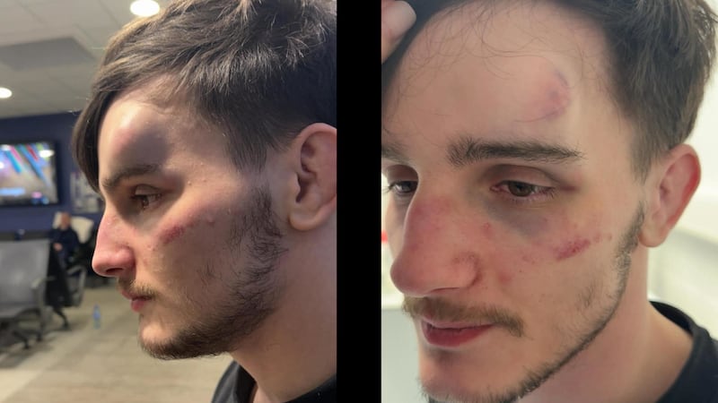 Mum says son ‘still in shock’ after gang attack at GAA club