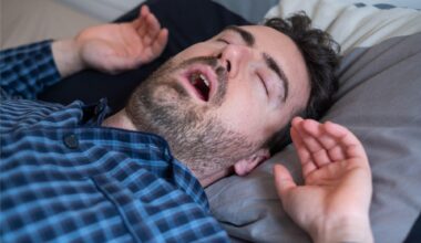 Obstructive Sleep Apnea Snoring