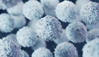 Overlooked Cells Linked to Poor Outcomes in Breast Cancer 