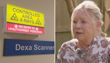 'It was horrifying': Jersey patient told she has osteoporosis eight years after bone density scan