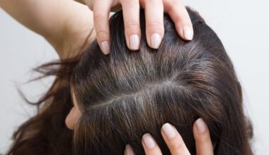 Why hair begins to turn grey and what you can do about it – The Irish Times