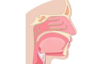 Stay Well: My husband’s constant cough is down to post-nasal drip. What is it and how does he get rid of it?