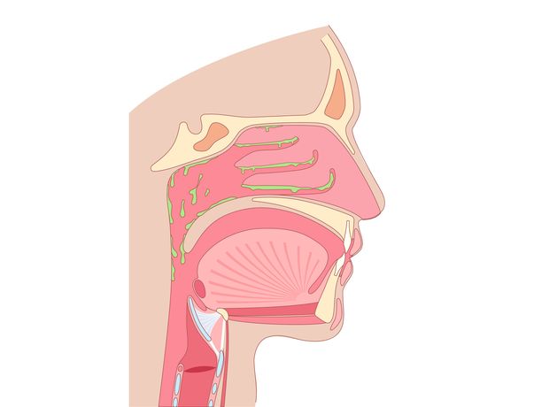 Stay Well: My husband’s constant cough is down to post-nasal drip. What is it and how does he get rid of it?