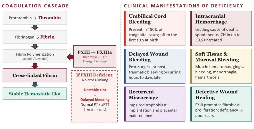 Anesthetic Management of a Patient With Factor XIII Deficiency Undergoing Encephaloduroarteriosynangiosis (EDAS): A Case Report and Literature Review