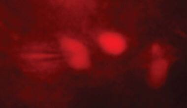 Study shows brain cells boost endurance benefits of exercise: Newsroom