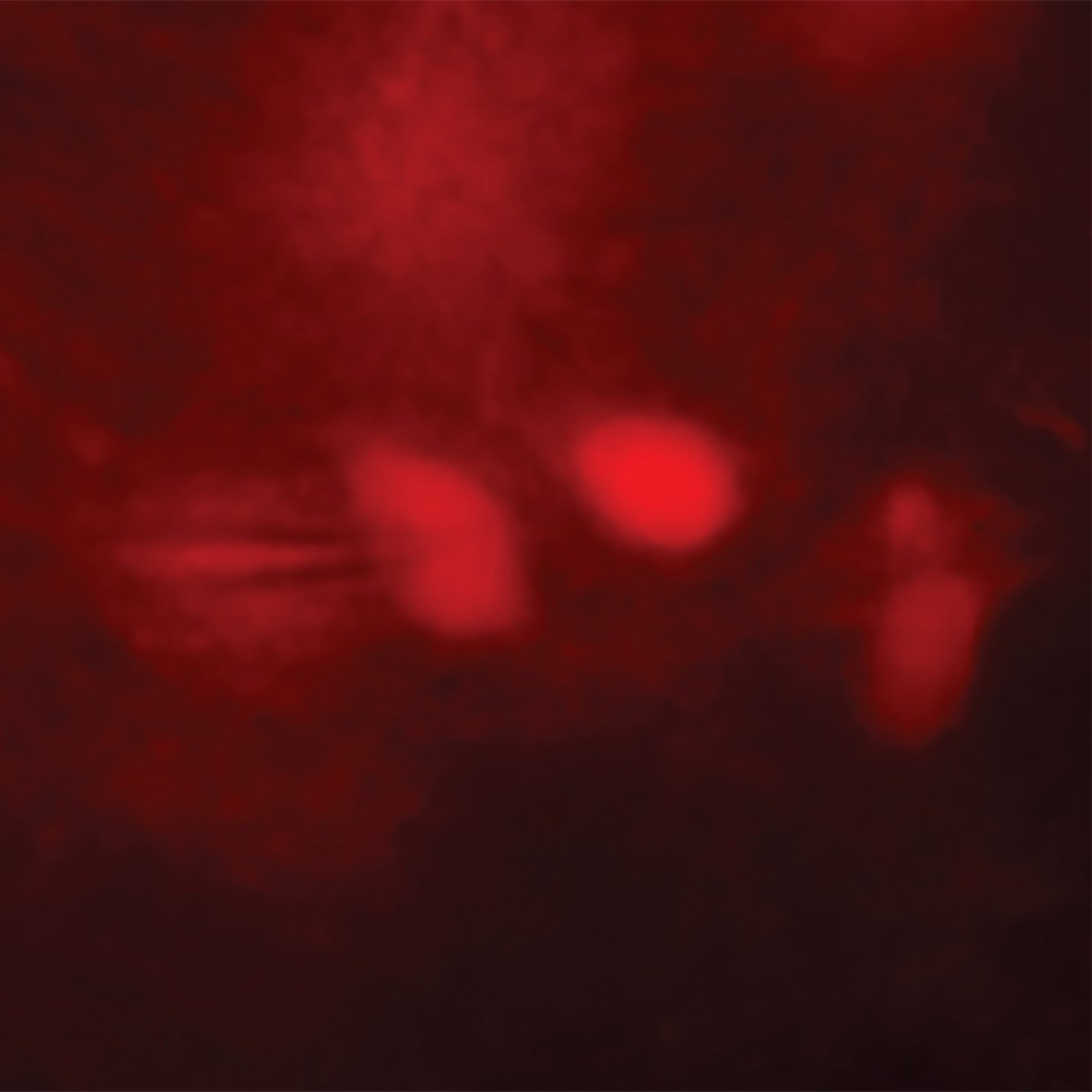 Study shows brain cells boost endurance benefits of exercise: Newsroom