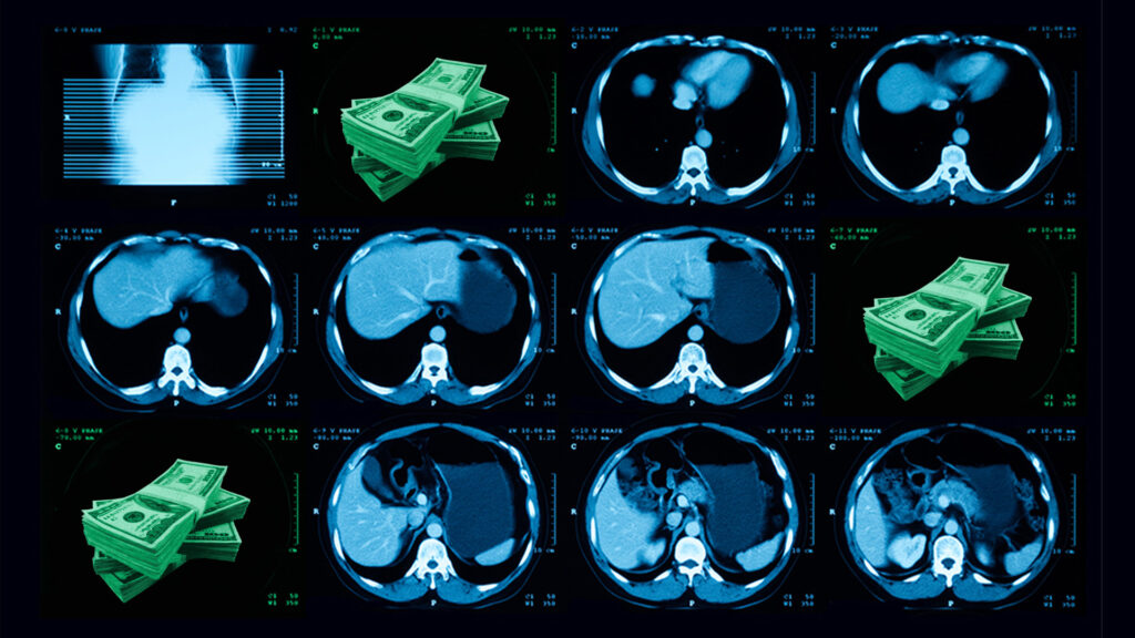 AI could check millions of lung cancer scans for heart risk. Who will pay for it?