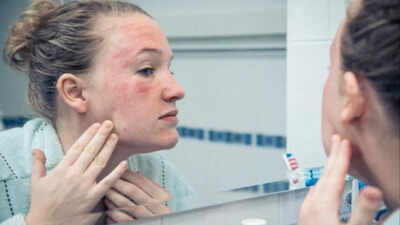 Recurring rashes, acne or redness? Dermatologists reveal hidden triggers behind skin inflammation, flare-ups