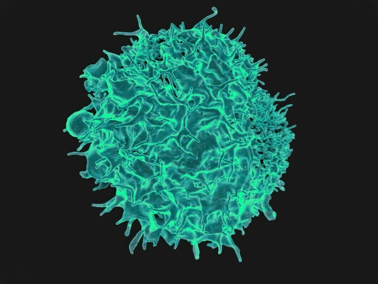 Green microscopic image of T lymphocyte