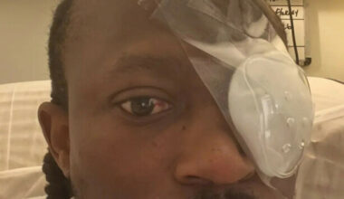 Man (20s) arrested in connection with assault that left Limerick hip hop artist partially blind