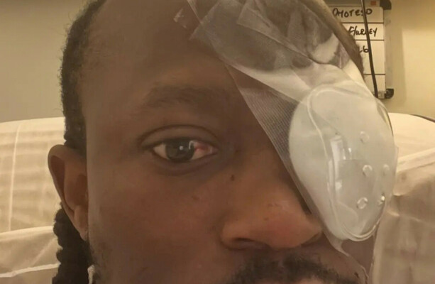 Man (20s) arrested in connection with assault that left Limerick hip hop artist partially blind
