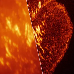 When cells invade, they grip — and now we can see exactly how. The combination of super-resolution imaging and newly developed spontaneously blinking Janelia Fluor dyes reveal the fine molecular architecture of focal adhesions that live cells use to migrate and invade tissue (right) — detail completely invisible to conventional imaging (left). Credit: Cathy Galbraith/OHSU