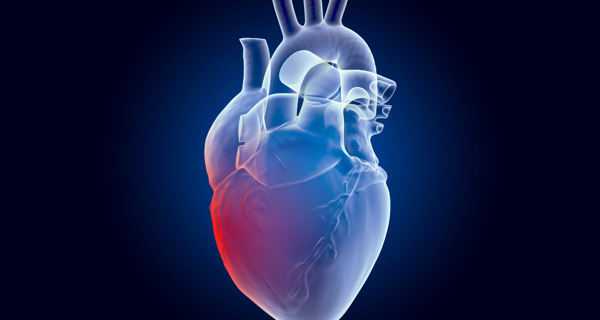 Early-Onset ICI-Related Myocarditis Linked to Increased Mortality