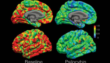 Different psychedelics create very similar brain wave patterns