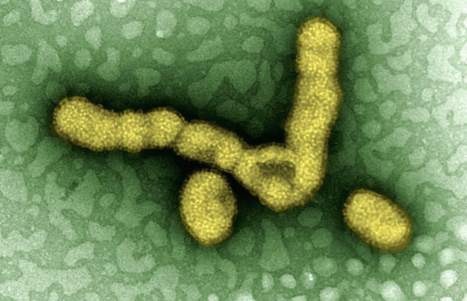 a cell with a yellow substance inside of it