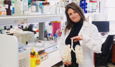 Israeli researcher advances 3D bioprinting toward organ transplants, 'opening door to