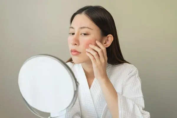 Why Do Your Skin Flare-Ups Keep Coming Back? The Answer Might Surprise You