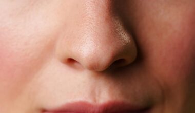 Beneficial bacteria in respiratory microbiome may protect against long-COVID symptoms