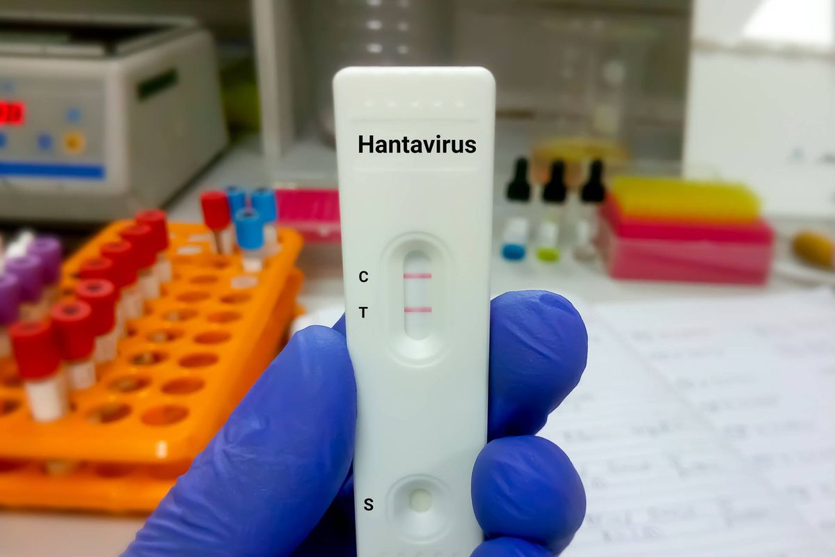 A positive hantavirus test