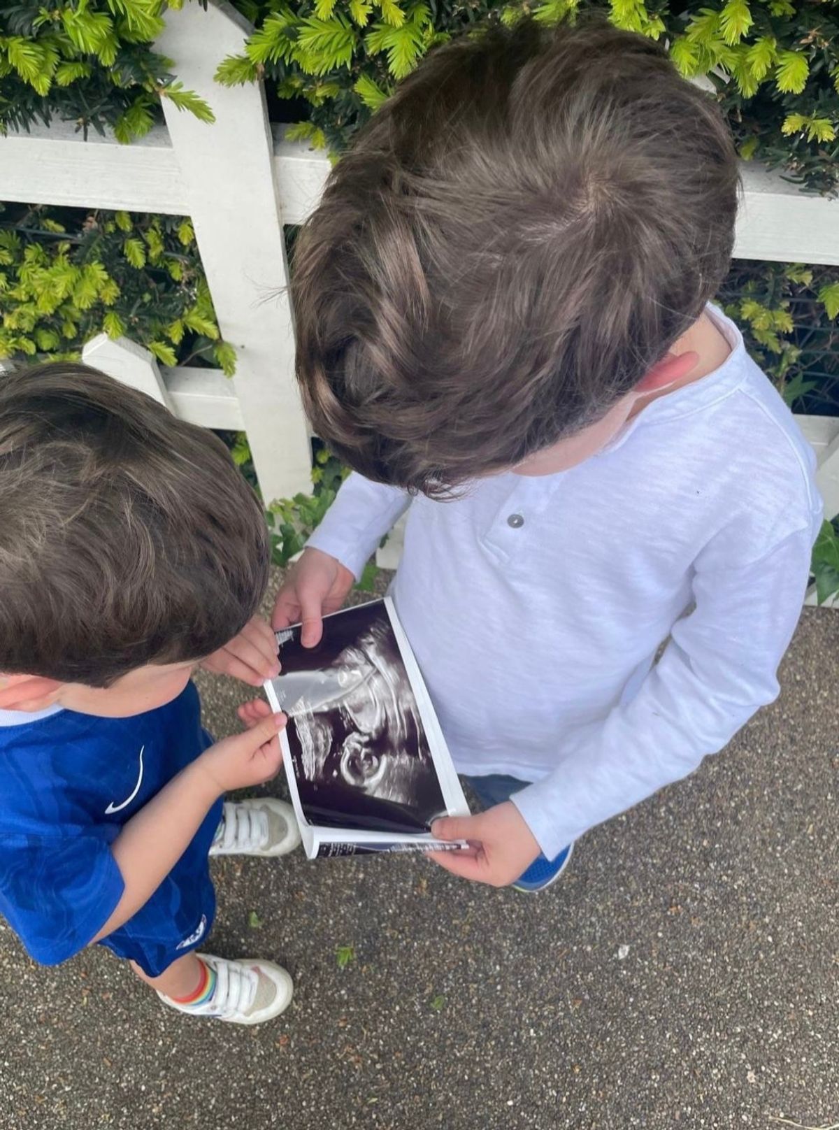 Eugenie baby scan