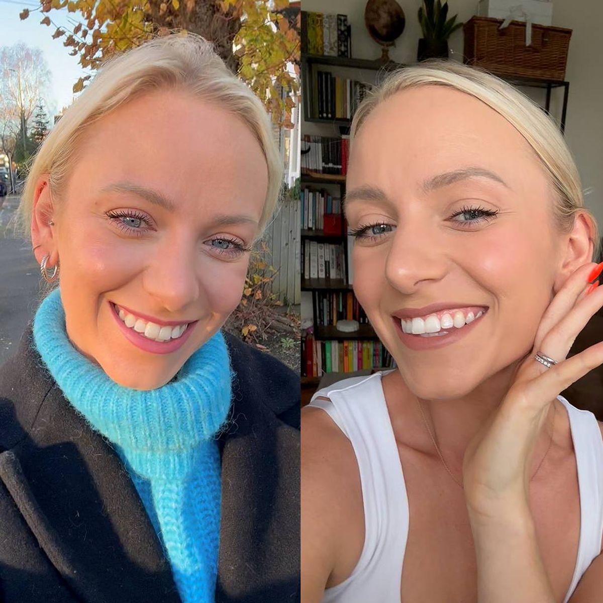A girl before and after using MySweetSmile.