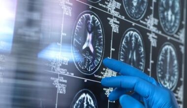 Treatment to slow Alzheimer’s approved, but €60,000 yearly price not covered by HSE or insurance